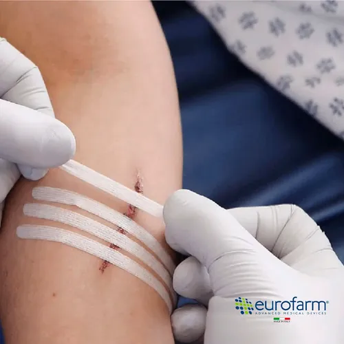EUROSUTURE