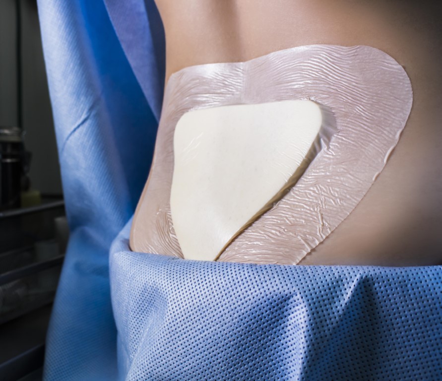 EURODERM FOAM SACRAL 